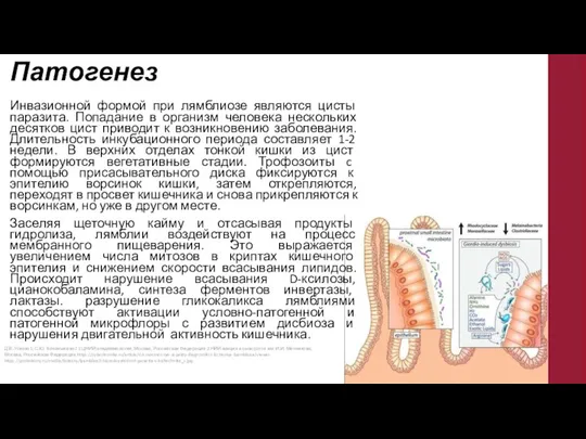 Патогенез Инвазионной формой при лямблиозе являются цисты паразита. Попадание в организм