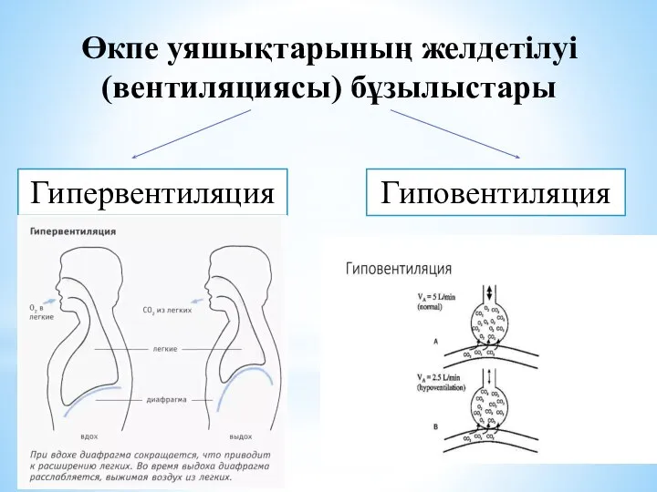 Өкпе уяшықтарының желдетілуі (вентиляциясы) бұзылыстары Гипервентиляция Гиповентиляция