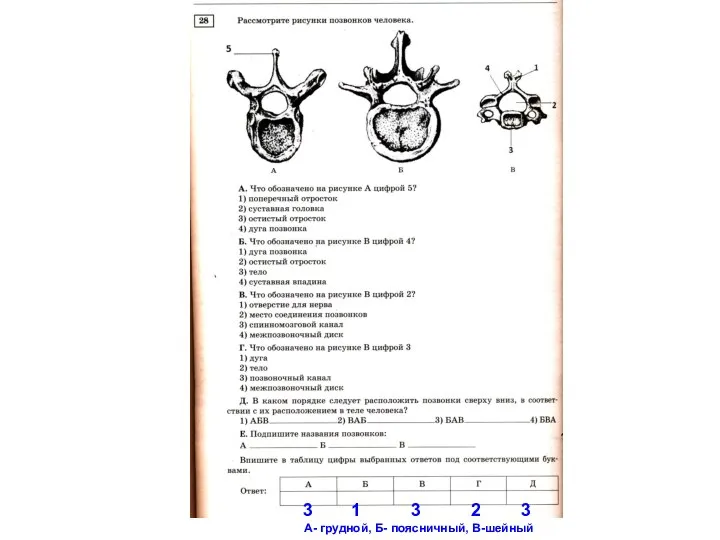 1 3 2 3 А- грудной, Б- поясничный, В-шейный
