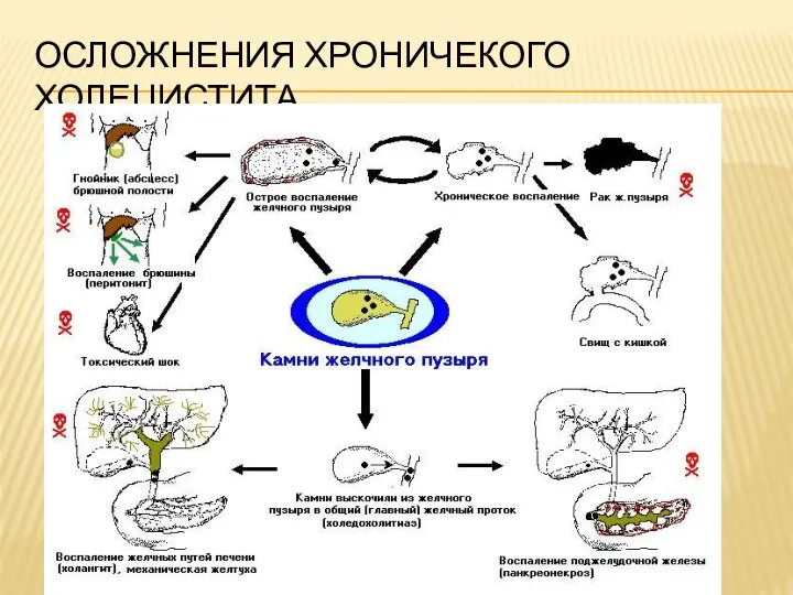 ОСЛОЖНЕНИЯ ХРОНИЧЕКОГО ХОЛЕЦИСТИТА