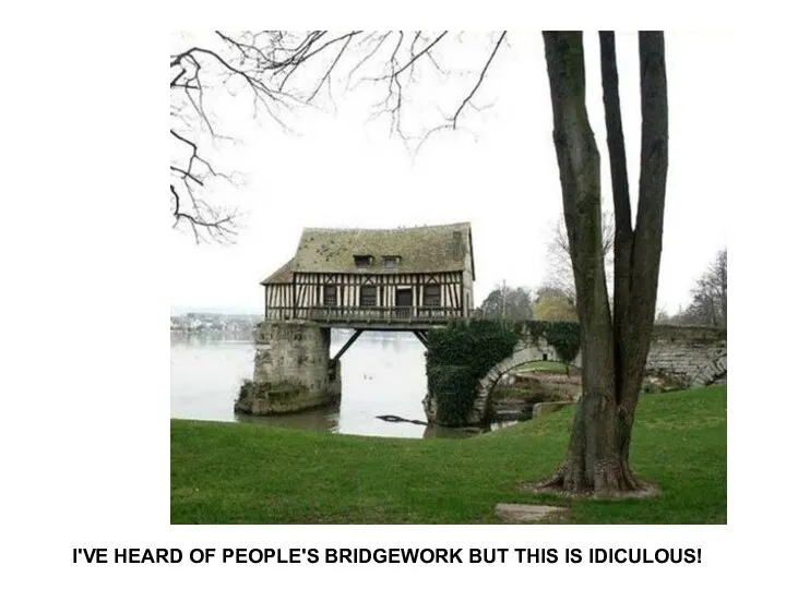 I'VE HEARD OF PEOPLE'S BRIDGEWORK BUT THIS IS IDICULOUS!