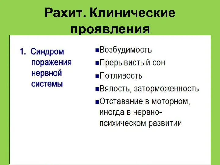 Рахит. Клинические проявления