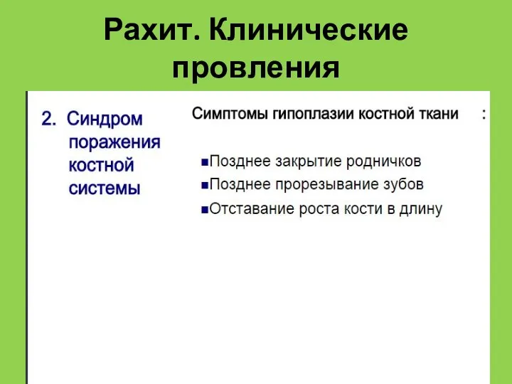 Рахит. Клинические провления