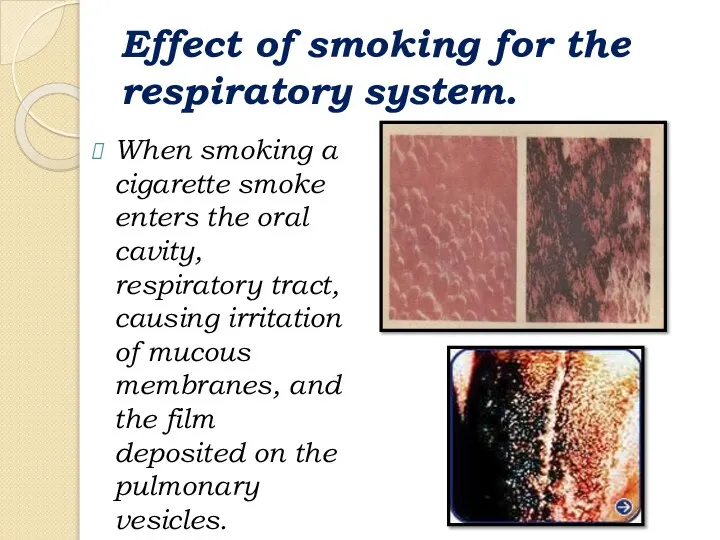 Effect of smoking for the respiratory system. When smoking a cigarette