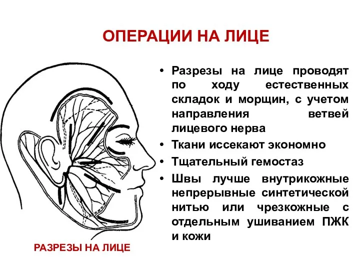 ОПЕРАЦИИ НА ЛИЦЕ Разрезы на лице проводят по ходу естественных складок