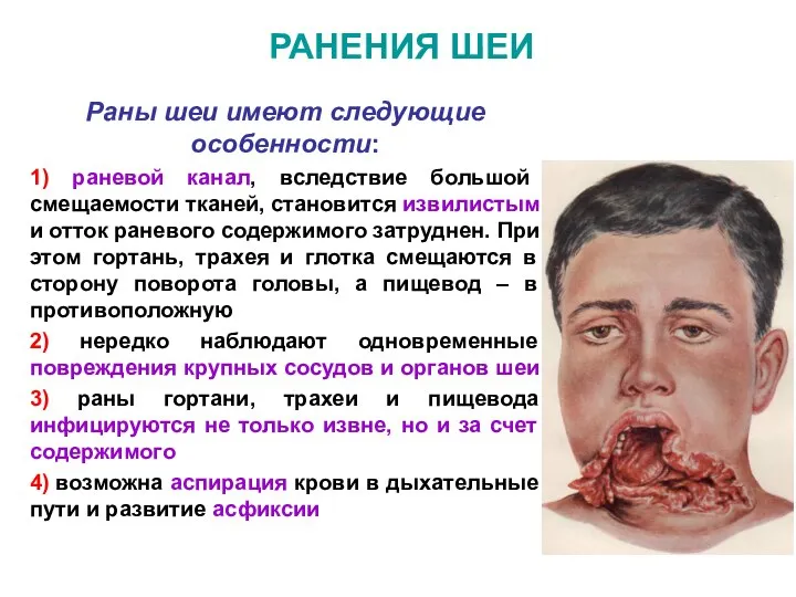 РАНЕНИЯ ШЕИ Раны шеи имеют следующие особенности: 1) раневой канал, вследствие