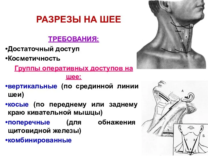 РАЗРЕЗЫ НА ШЕЕ ТРЕБОВАНИЯ: Достаточный доступ Косметичность Группы оперативных доступов на