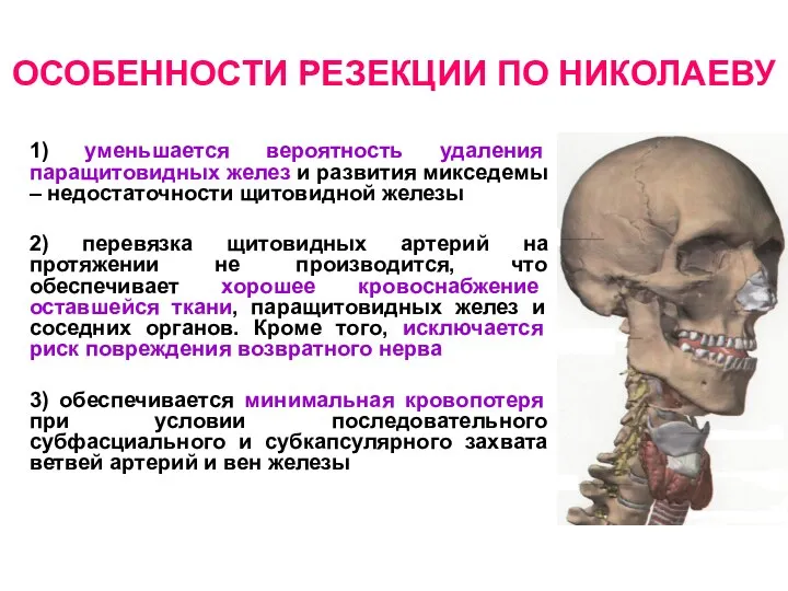 ОСОБЕННОСТИ РЕЗЕКЦИИ ПО НИКОЛАЕВУ 1) уменьшается вероятность удаления паращитовидных желез и