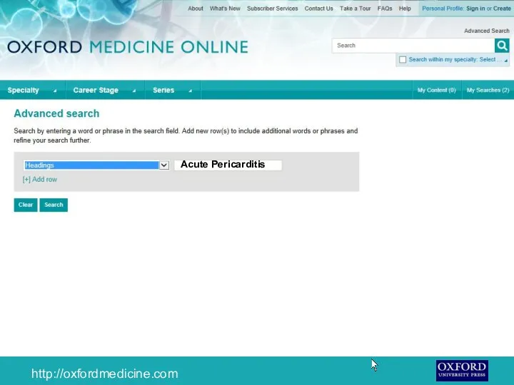 Acute Pericarditis