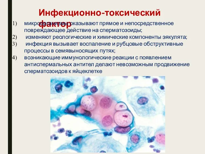 Инфекционно-токсический фактор микроорганизмы оказывают прямое и непосредственное повреждающее действие на сперматозоиды;