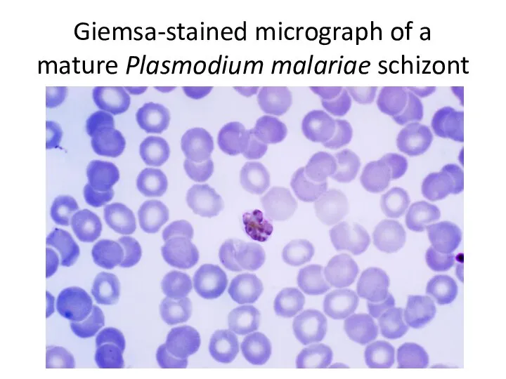 Giemsa-stained micrograph of a mature Plasmodium malariae schizont