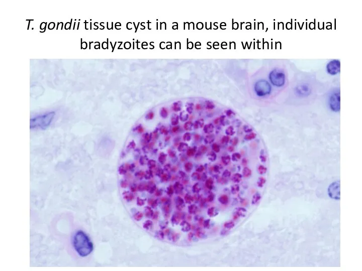 T. gondii tissue cyst in a mouse brain, individual bradyzoites can be seen within