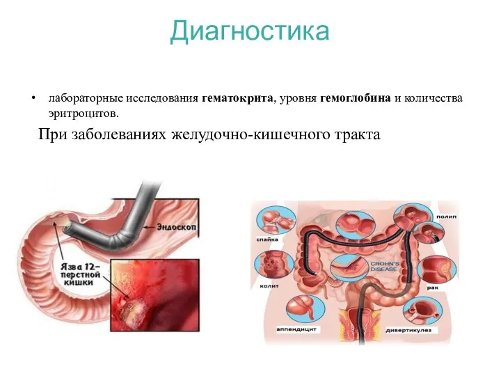 Диагностика лабораторные исследования гематокрита, уровня гемоглобина и количества эритроцитов. При заболеваниях желудочно-кишечного тракта