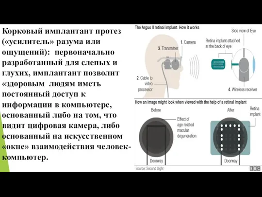 Корковый имплантант протез («усилитель» разума или ощущений): первоначально разработанный для слепых