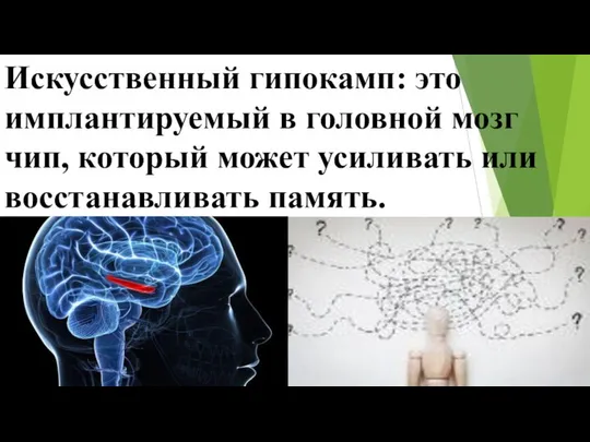 Искусственный гипокамп: это имплантируемый в головной мозг чип, который может усиливать или восстанавливать память.