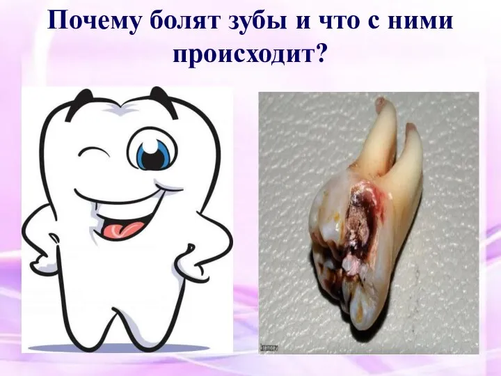 Почему болят зубы и что с ними происходит?