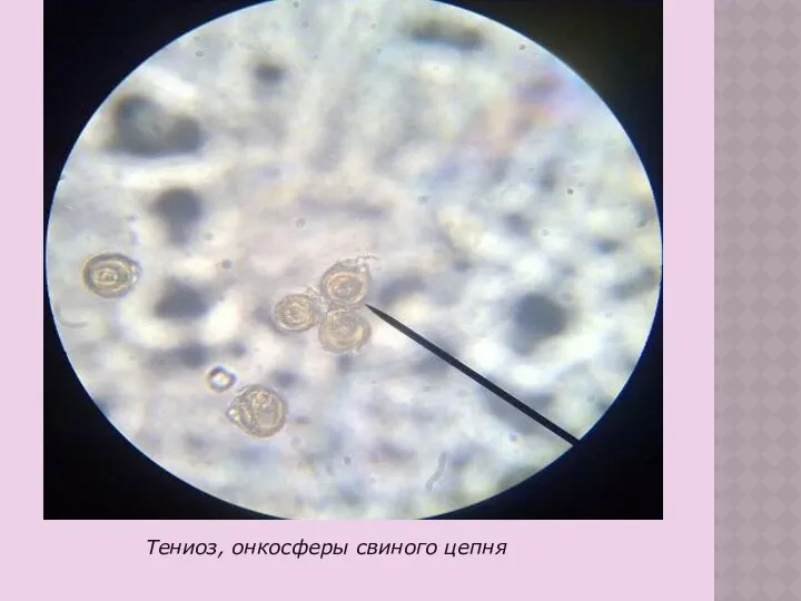 Тениоз, онкосферы свиного цепня