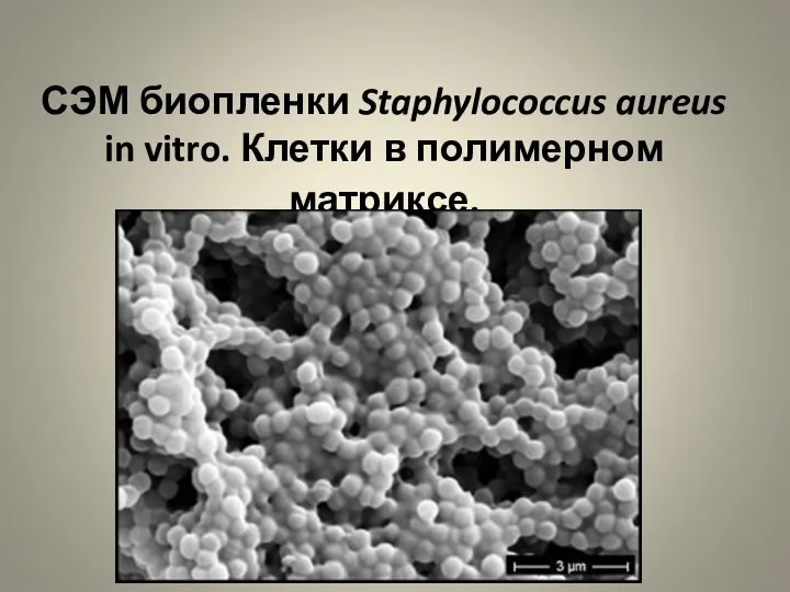 СЭМ биопленки Staphylococcus aureus in vitro. Клетки в полимерном матриксе.