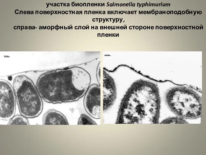 (ТЭМ) УЛЬТРАТОНКИЙ СРЕЗ участка биопленки Salmonella typhimurium Слева поверхностная пленка включает