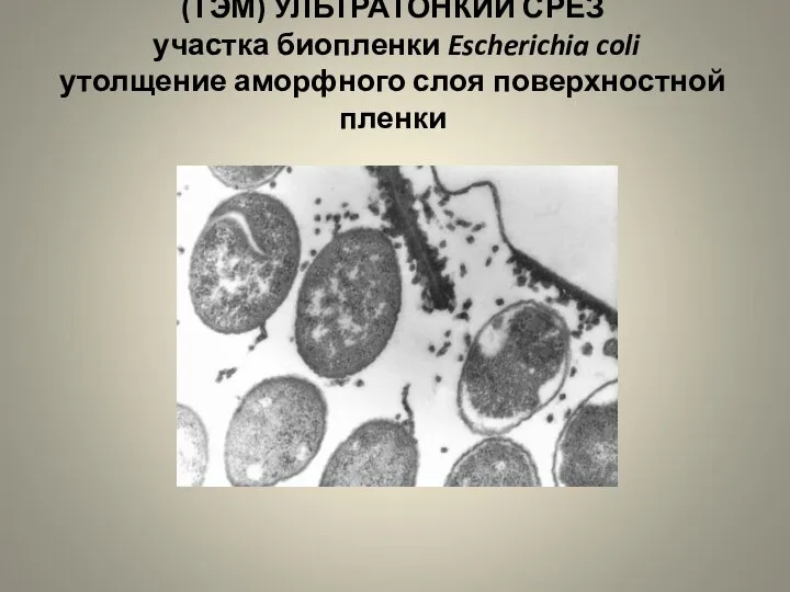 (ТЭМ) УЛЬТРАТОНКИЙ СРЕЗ участка биопленки Escherichia coli утолщение аморфного слоя поверхностной пленки