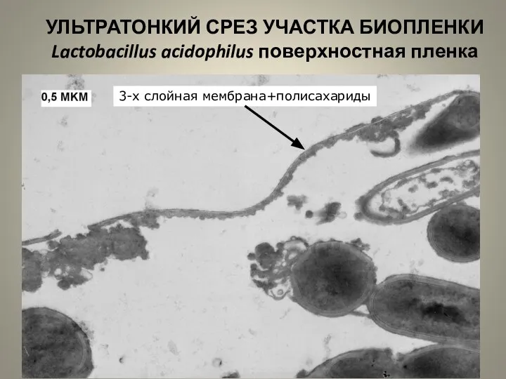 УЛЬТРАТОНКИЙ СРЕЗ УЧАСТКА БИОПЛЕНКИ Lactobacillus acidophilus поверхностная пленка 3-х слойная мембрана+полисахариды