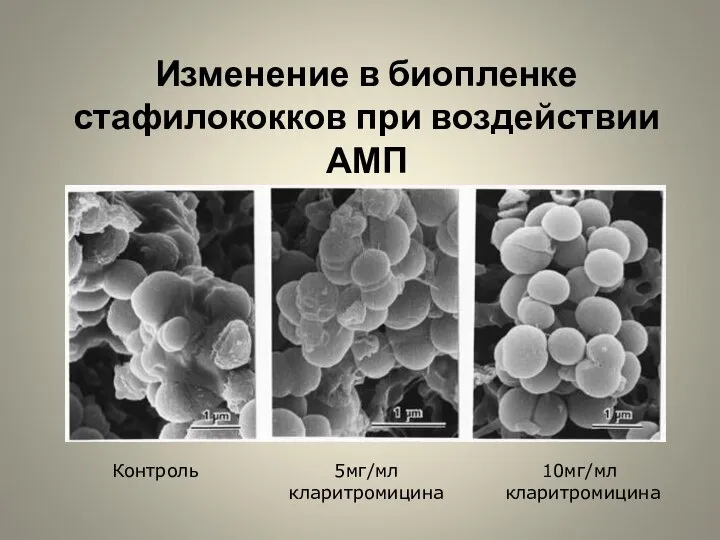 Изменение в биопленке стафилококков при воздействии АМП Контроль 5мг/мл кларитромицина 10мг/мл кларитромицина