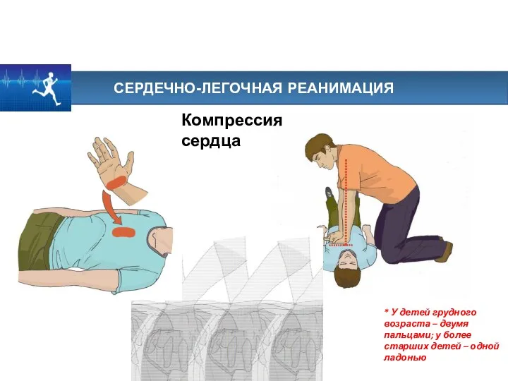 СЕРДЕЧНО-ЛЕГОЧНАЯ РЕАНИМАЦИЯ * У детей грудного возраста – двумя пальцами; у