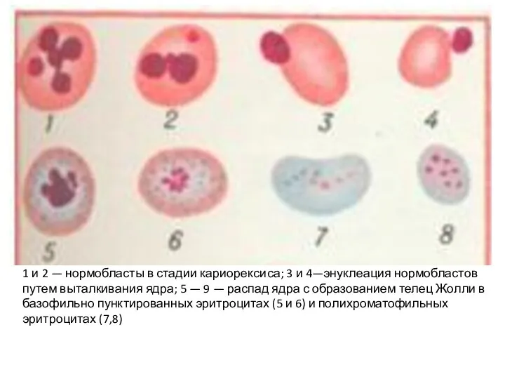 1 и 2 — нормобласты в стадии кариорексиса; 3 и 4—энуклеация