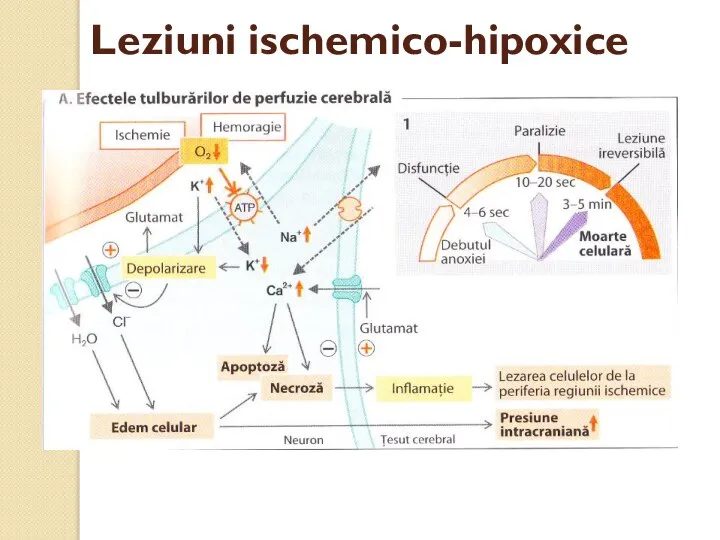 Leziuni ischemico-hipoxice