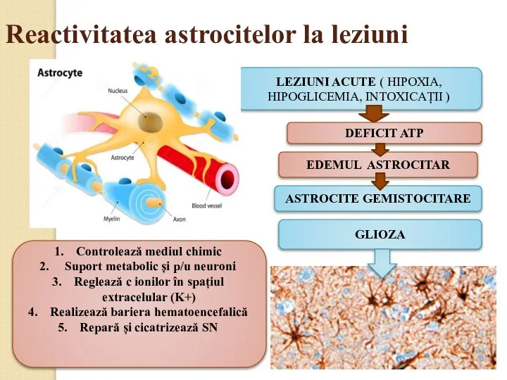 Reactivitatea astrocitelor la leziuni GLIOZA LEZIUNI ACUTE ( HIPOXIA, HIPOGLICEMIA, INTOXICAȚII