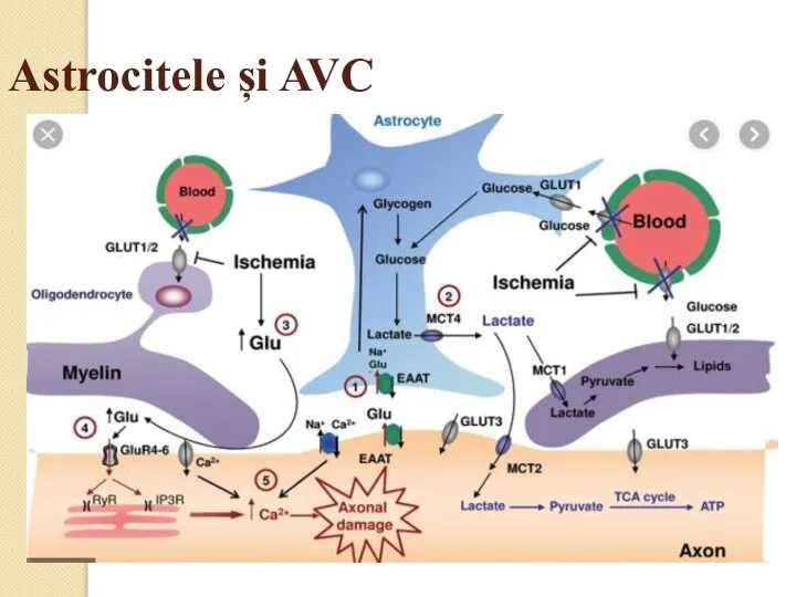 Astrocitele și AVC