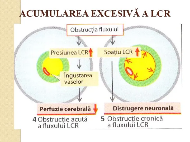 ACUMULAREA EXCESIVĂ A LCR