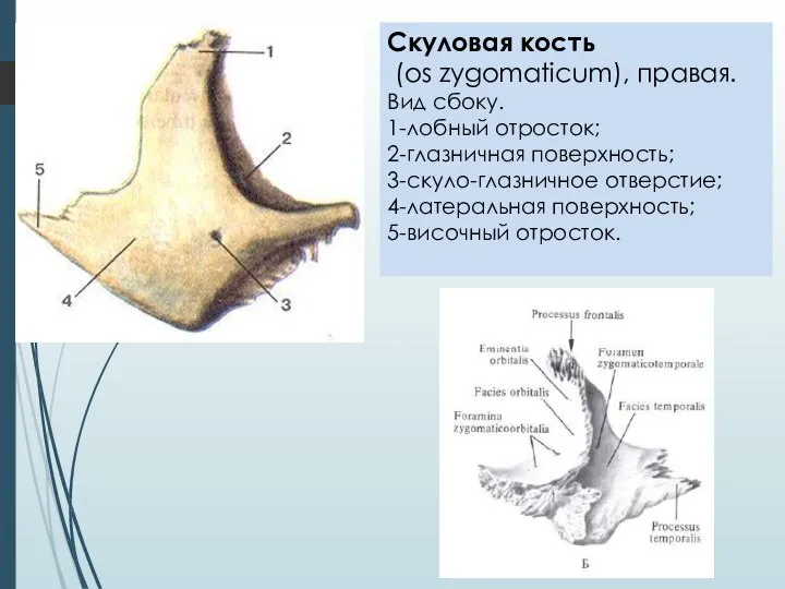 Скуловая кость (os zygomaticum), правая. Вид сбоку. 1-лобный отросток; 2-глазничная поверхность;