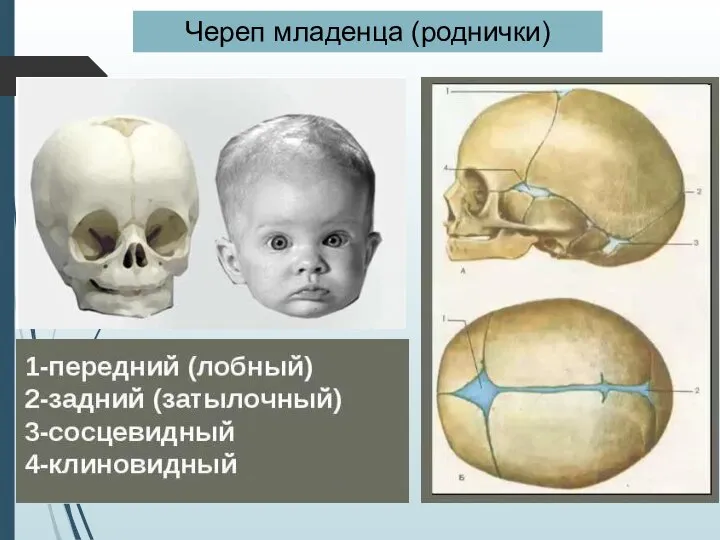 Череп младенца (роднички)