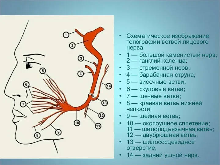 Схематическое изображение топографии ветвей лицевого нерва: 1 — большой каменистый нерв;