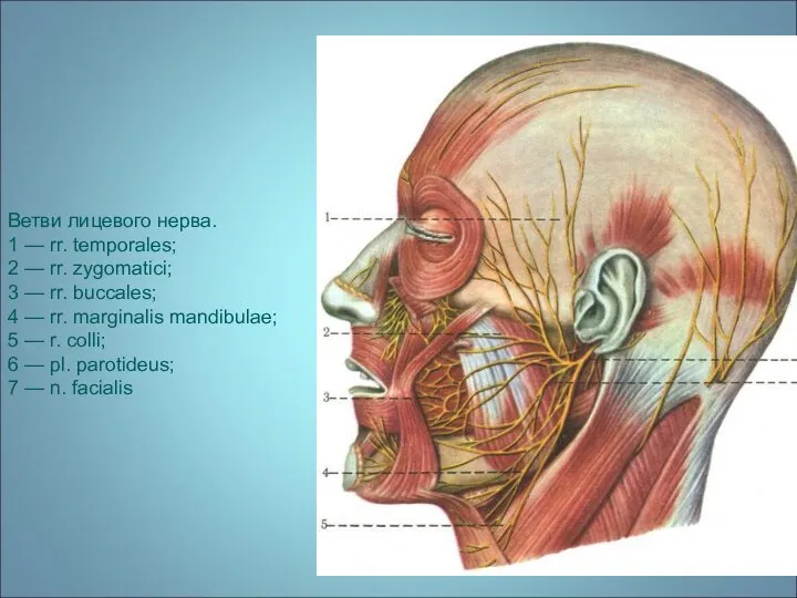 Ветви лицевого нерва. 1 — rr. temporales; 2 — rr. zygomatici;