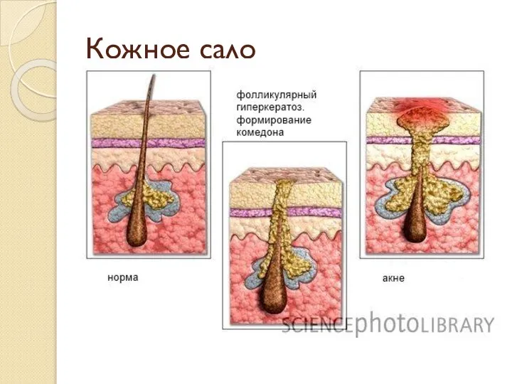 Кожное сало