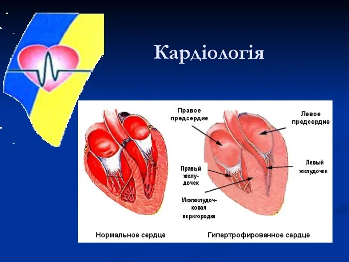 Кардіологія