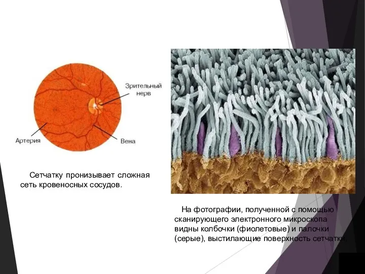 На фотографии, полученной с помощью сканирующего электронного микроскопа видны колбочки (фиолетовые)