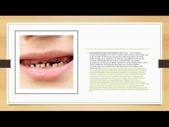 Осложнения пигментации зубовПигментация — это не просто косметический дефект, а сигнал