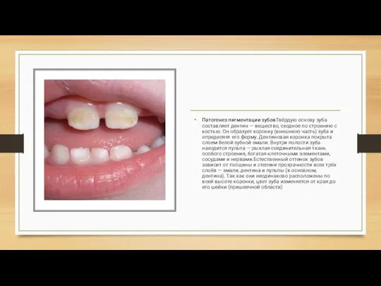 Патогенез пигментации зубовТвёрдую основу зуба составляет дентин — вещество, сходное по