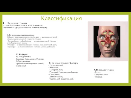 Классификация II. По месту локализации выделяют: -Гайморит (синусит верхнечелюстной пазухи) —