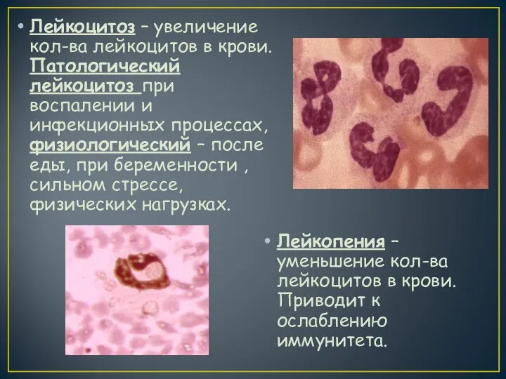 Лейкоцитоз – увеличение кол-ва лейкоцитов в крови. Патологический лейкоцитоз при воспалении