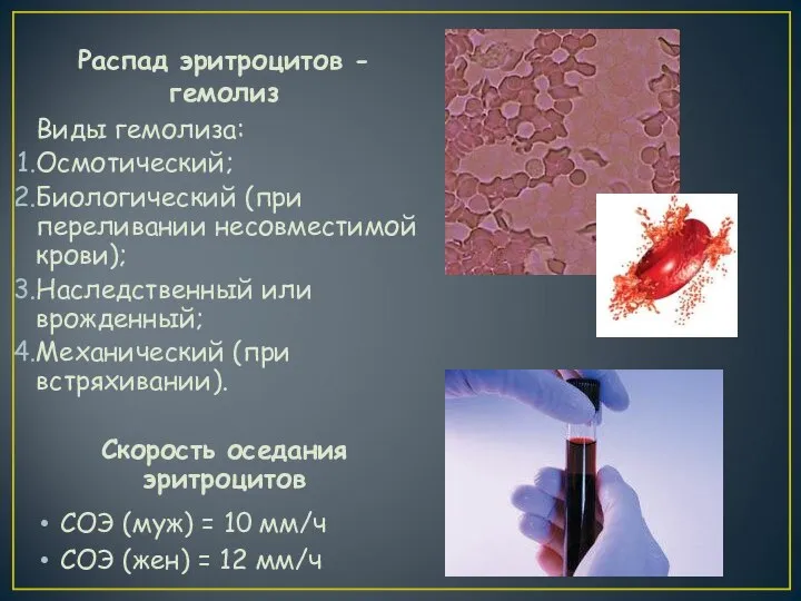 Распад эритроцитов - гемолиз Виды гемолиза: Осмотический; Биологический (при переливании несовместимой