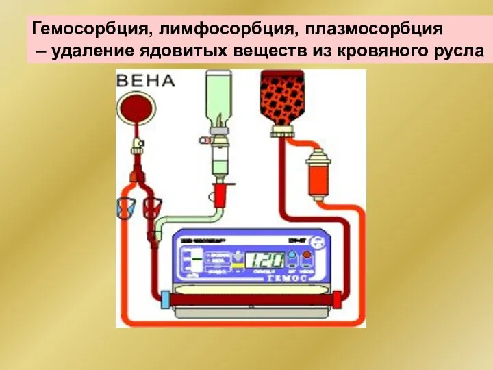 Гемосорбция, лимфосорбция, плазмосорбция – удаление ядовитых веществ из кровяного русла