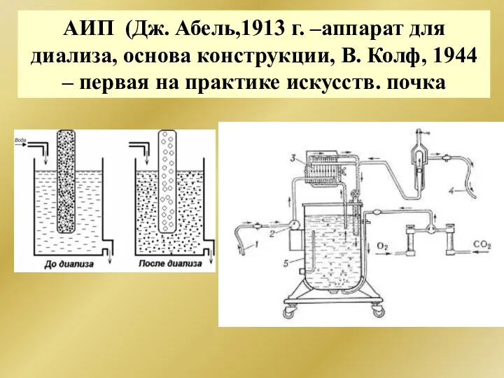 АИП (Дж. Абель,1913 г. –аппарат для диализа, основа конструкции, В. Колф,