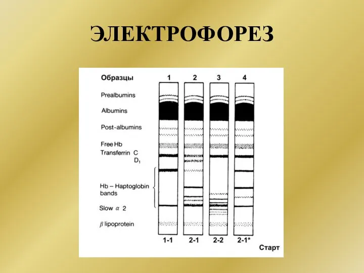 ЭЛЕКТРОФОРЕЗ