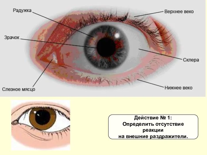 Действие № 1: Определить отсутствие реакции на внешние раздражители.