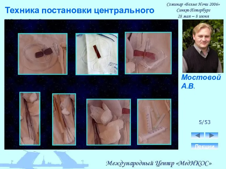 Техника постановки центрального катетера. Лекции 5/53 Мостовой А.В.