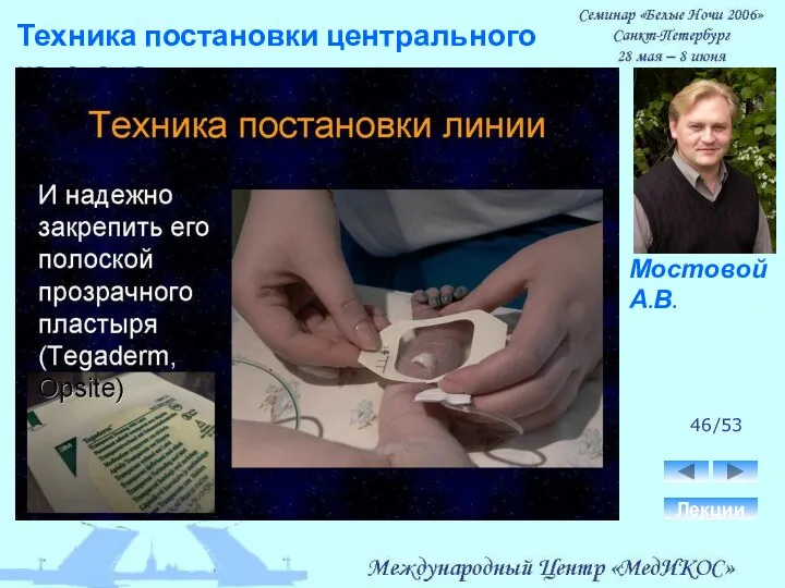 Техника постановки центрального катетера. Лекции 46/53 Мостовой А.В.